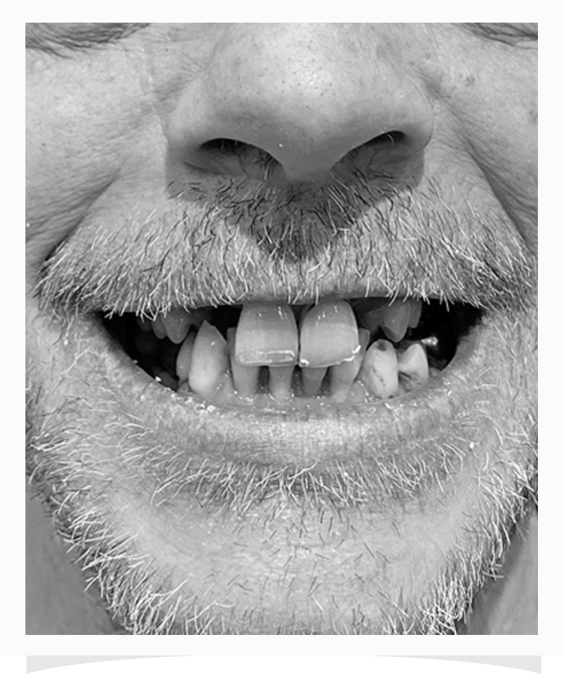 Franklin Dental Before Image