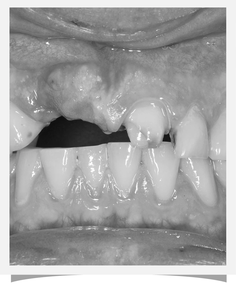 Cosmetic Dentistry Results- Before 2
