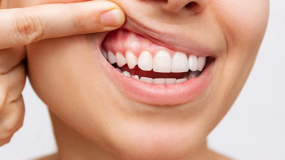 Benefits of regular dental cleaning